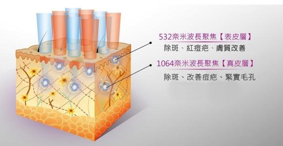 祛痘我用點陣，你呢？！