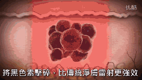 皮秒激光儀器的一些問題的解答！