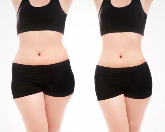 UltraShape優(yōu)立塑非侵入式專利科技、有效、安全！